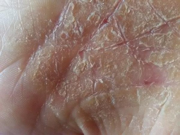 18834396_1535267536497751_364844445_n