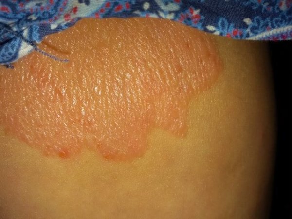 18870766_1535266836497821_1683964949_n